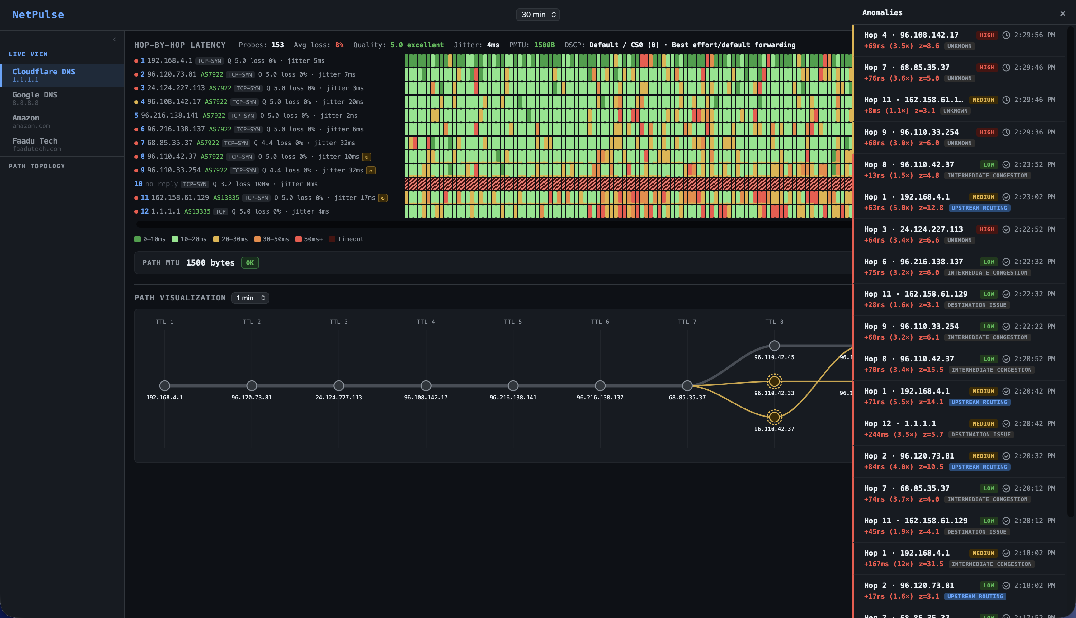 NetPulse anomaly history view  logged anomalies with classification tags, duration, confidence, and one-line RCA summary